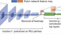 Breast Cancer Detection