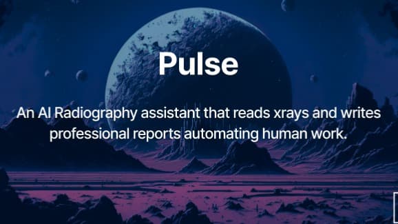 Pulse