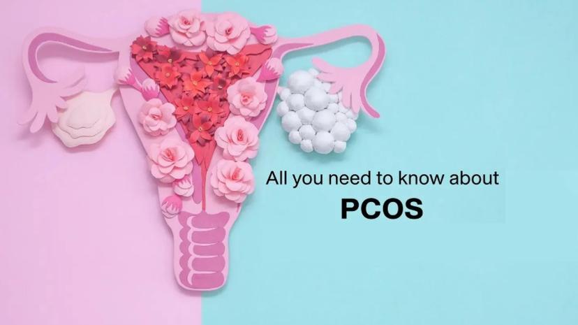 AI Powered PCOS Assistant