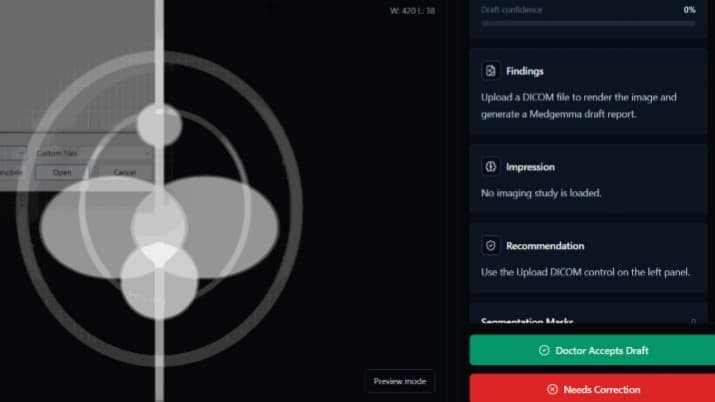Radiology AI
